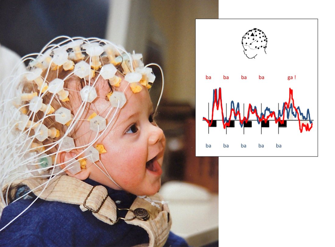 Enregistrement EEG chez un nourrisson / EEG recording in an infant